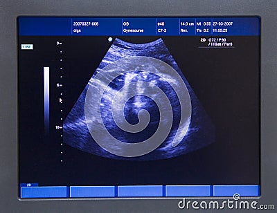 Baby in his mother's stomach made by ultrasound Stock Photo