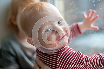 Baby with manifestations of food allergy Stock Photo