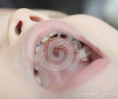 Baby open mouth Stock Photo