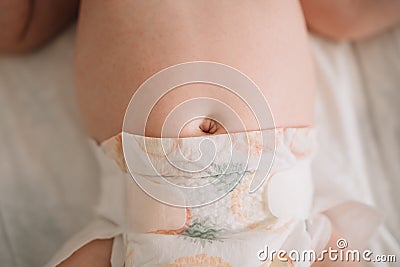 The baby`s navel. healthy stomach, a cure for gas in newborns. intestinal colic Stock Photo