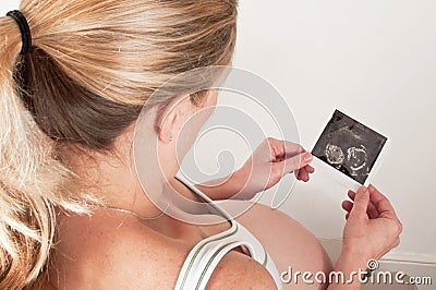 Baby scan Stock Photo