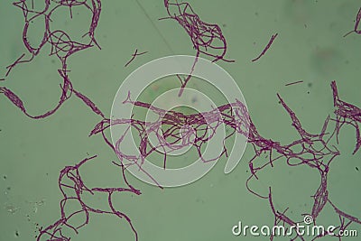 Bacillus anthracis anthrax 200x Stock Photo