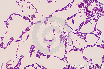 Bacillus gram positive stain under microscope view. Bacillus is rod-shaped bacteria Stock Photo