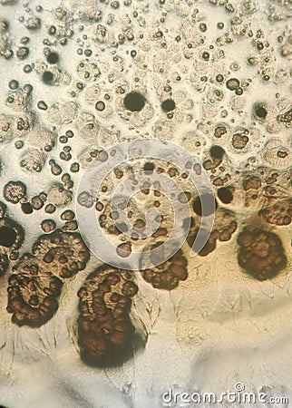 Bacillus subtilis growing on nutrient agar medium under the microcope Stock Photo