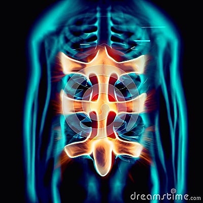 Back problems, pain, sciatica, spine Stock Photo