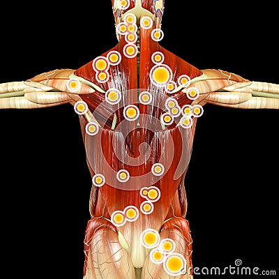 Back view of a man and his trigger points. Anatomy muscles. Myofascial trigger points. 3d rendering Stock Photo