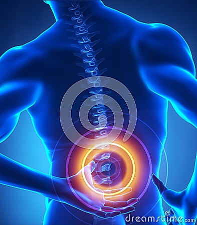 Backbone problem x-ray view Stock Photo