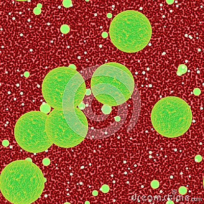 Bacteria Blood Infection or bacterial sepsis as a medical illustration Cartoon Illustration