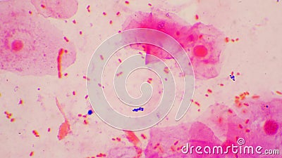 Bacteria cell Gram neagative bacilli with capsule pathogen.Sample sputum in Gram stain method Stock Photo