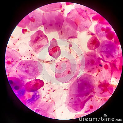 Bacteria cell Gram neagative bacilli with capsule.Sample sputum in Gram stain method Stock Photo
