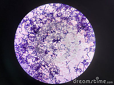 Bacteria cell in gram stain testing. Stock Photo