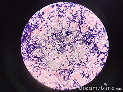 Bacteria cell in gram stain testing. Stock Photo