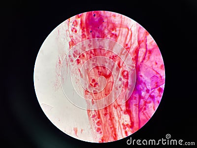 Bacteria cell in sputum sample Gram stain method Stock Photo