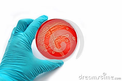 Bacteria colonies Stock Photo