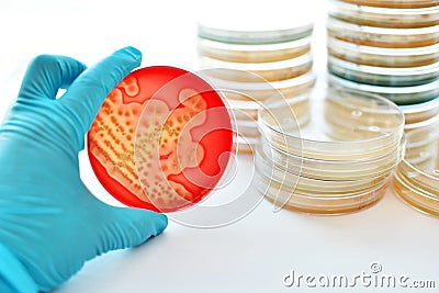 Bacteria colonies Stock Photo