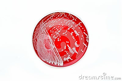 Bacteria colonies Stock Photo