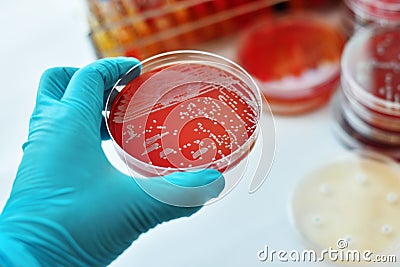 Bacteria colonies Stock Photo