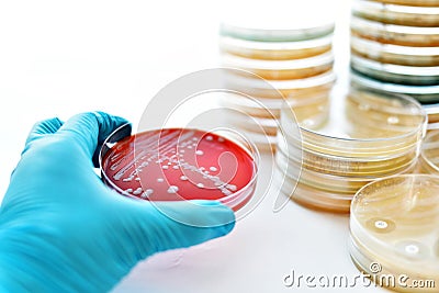 Bacteria colonies Stock Photo