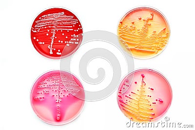 Bacteria colonies Stock Photo