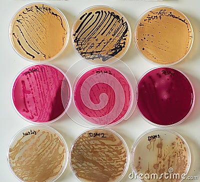 bacteria colonies on Selective media Agar Plates in various petri dish Stock Photo