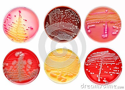 Bacteria colonies Stock Photo