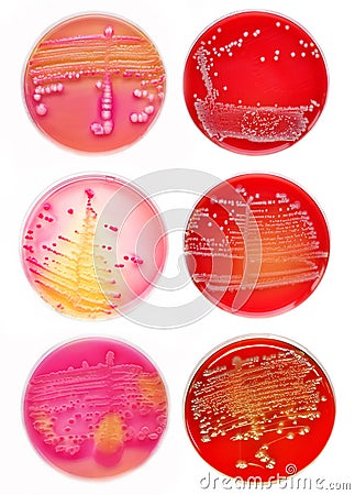 Bacteria colonies Stock Photo