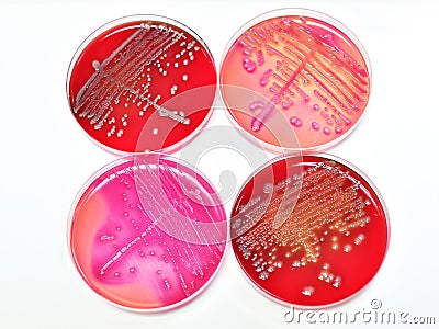 Bacteria culture Stock Photo