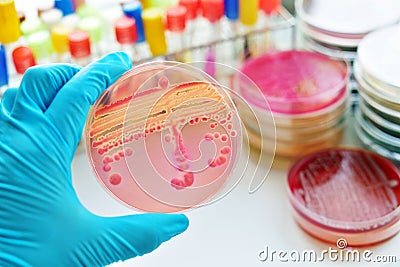 Bacteria culture Stock Photo