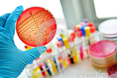 Bacteria culture Stock Photo