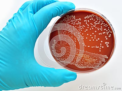 Bacteria culture Stock Photo