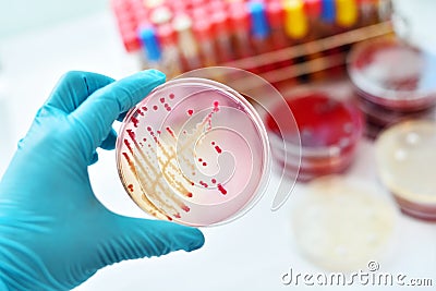 Bacteria culture Stock Photo