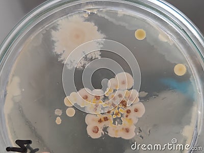 Bacteria and fungi on sabouraud dextrose agar medium Stock Photo