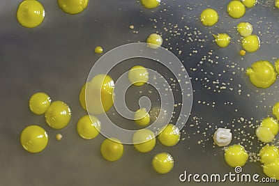 Bacteria grown from skin smear Stock Photo