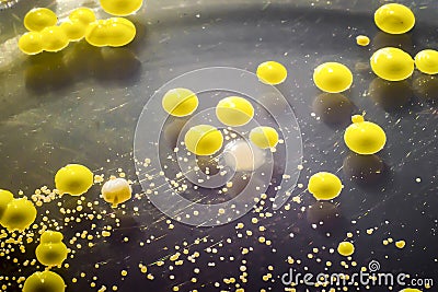 Bacteria grown from skin smear, colonies of Micrococcus luteus and Staphylococcus epidermidis Stock Photo