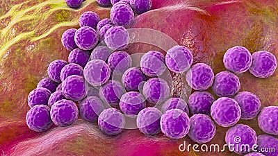 Bacteria Staphylococcus aureus Cartoon Illustration