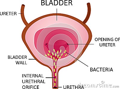 Bacteria in urinary bladder or simply bladder. Green small cell which causes inflammation. Vector Illustration