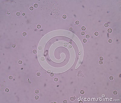 Bacteria in urine specimen Stock Photo