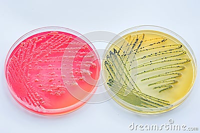 Bacterial colonies culture on Differential and Selective media Stock Photo