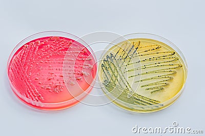 Bacterial colonies culture on Differential and Selective media Stock Photo