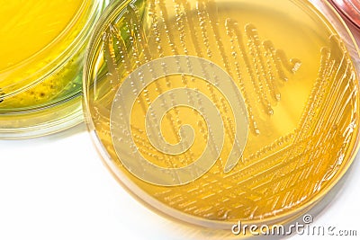 Bacterial colonies culture on MacConkey agar media(Pseudomonas a Stock Photo