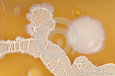 Bacterial colonies from dirty hands. Stock Photo