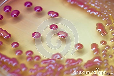 Bacterial culture growth on MacConkey agar. Stock Photo