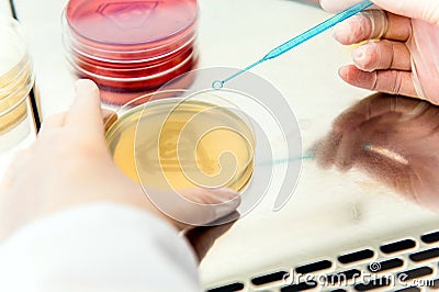 Bacterial culture Stock Photo