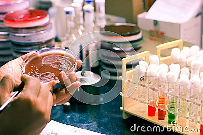 Bacterial Inoculation on a culture plate using inoculation loop by scientist lab technician in microbiology laboratory Stock Photo