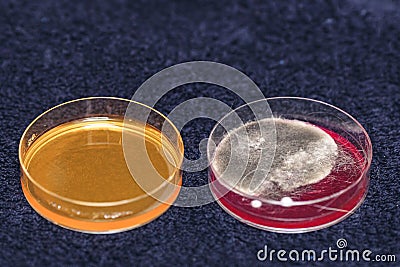 bacterial inoculation in laboratory dishes, grown colonies of bacteria or fungi Stock Photo
