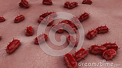 Bacterial Meningitis Stock Photo