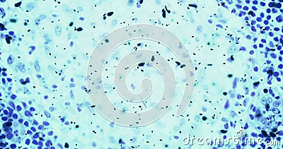 Bacteriën of kiemenmicro-organismecellen onder microscoop in de kleuren chemische blauwe vloeistof stock video Bacteriën of kiemenmicro-organismecellen onder microscoop in de kleuren chemische blauwe vloeistof stock video