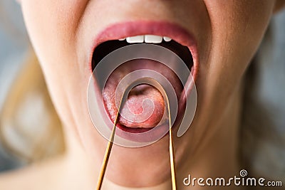 Bad Breath Tongue Scraper Stock Photo