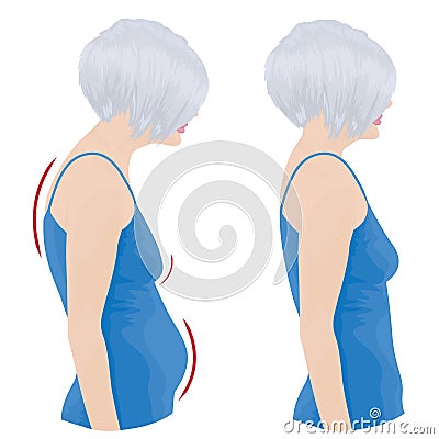 Bad and good posture Vector Illustration