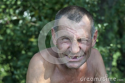 Bad teeth, smile Stock Photo